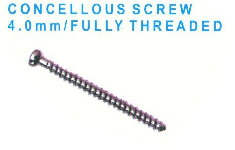 Concellous Screw Full Thread_img_2913